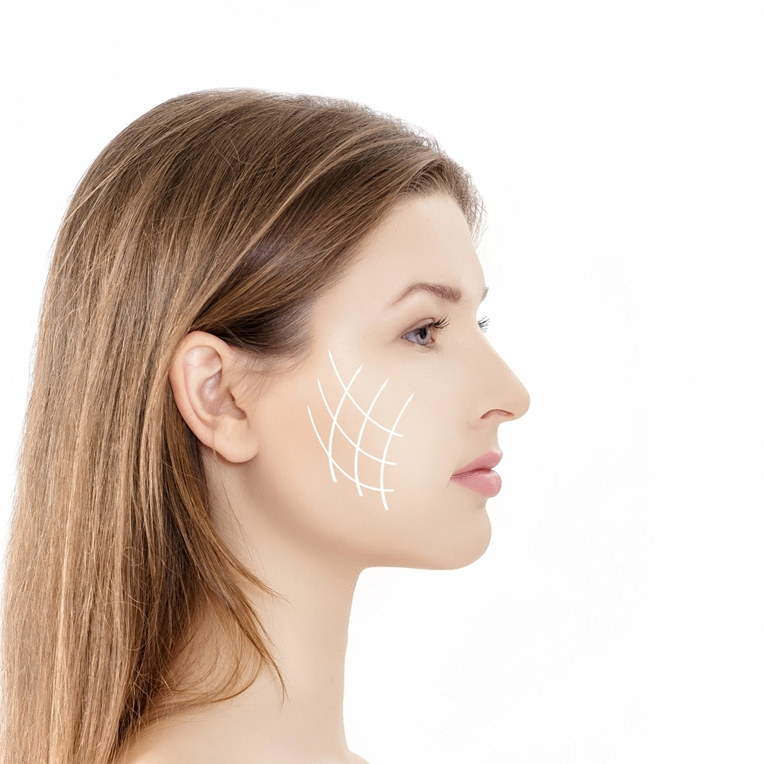 Tratamento de paralisia de Bell realizado por Luciana Simone para reabilitação facial e recuperação muscular