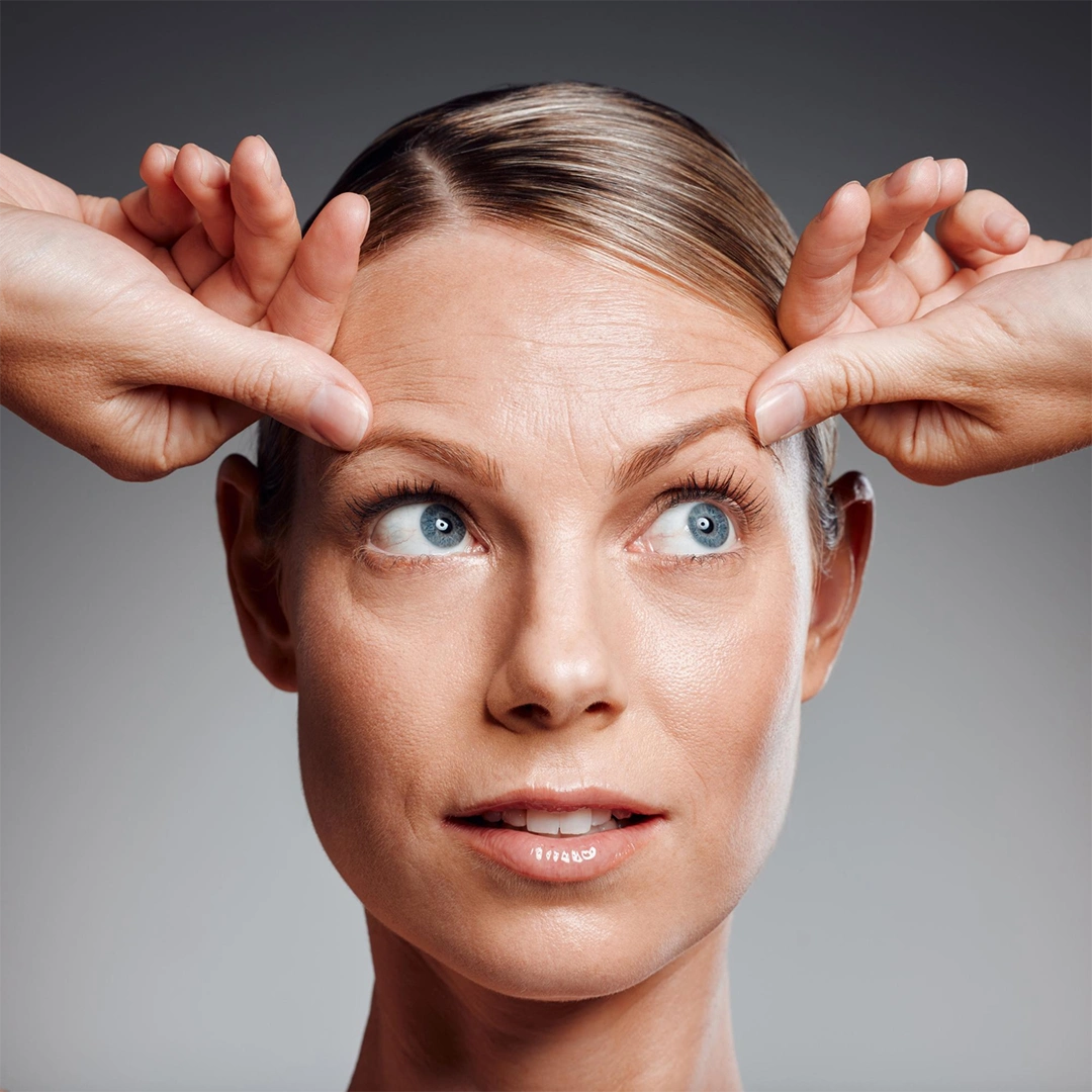 Aplicação de toxina botulínica (botox) para tratamentos estéticos realizada por Luciana Simone